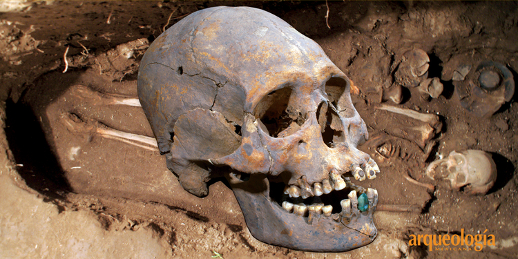 Una prótesis dental en Teotihuacan